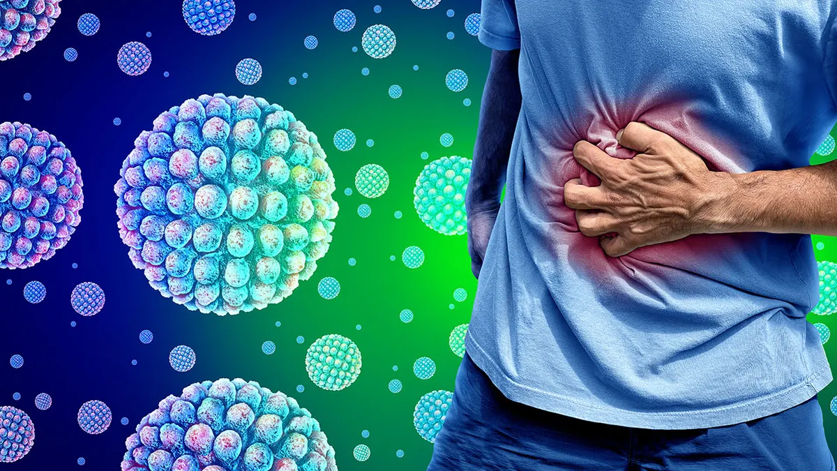 New wave of stomach virus spreads rapidly, raising concern for patients