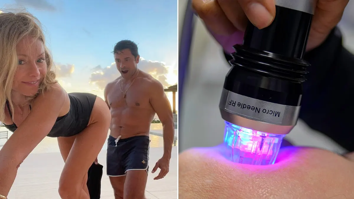 Kelly Ripa’s butt microneedling procedure explained by a dermatologist