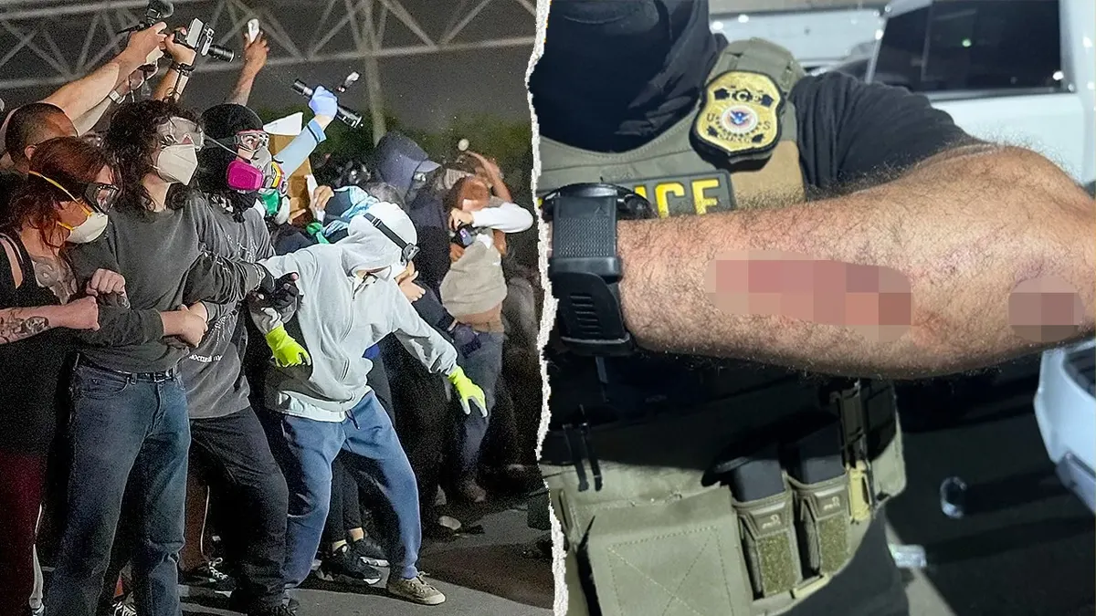 New Jersey man arrested for allegedly biting ICE officers at Newark protest