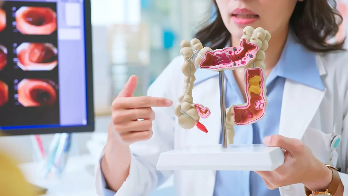 American Cancer Society updates colorectal cancer screening guidelines