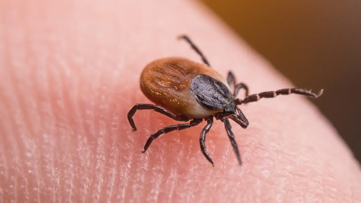 Tick bite ER visits hit highest seasonal level amid Lyme disease surge Tick bite ER visits hit highest seasonal level amid Lyme disease surge